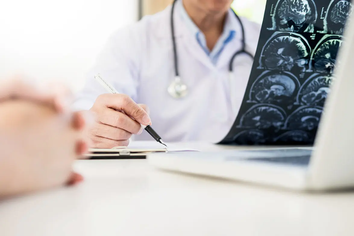 Doctor examining xrays of a brain injury victim