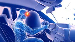 Car Accident Injury-TBI