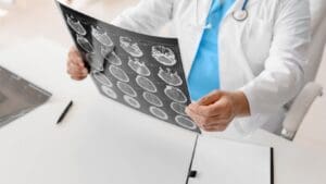 Medical professional carefully reviewing a detailed MRI scan showing traumatic brain injuries (TBIs). The MRI clearly shows brain scans crucial for determining injury severity, impacting the average brain injury settlement amount. Munley Law, Allentown, PA, offers expert legal guidance on brain injury settlements at (855) 866-5529. Understanding medical findings is key to estimating settlement values accurately.